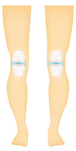 सिनोवियल जॉइंट्स की किस्में