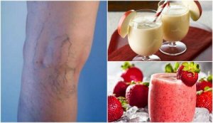 वेरीकोस वेंस को कम करने वाली स्मूदी