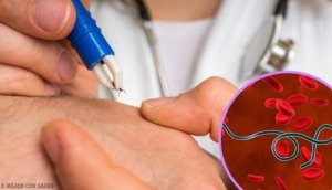 लाइम रोग के लक्षण जिन्हें जान लेना ज़रूरी है