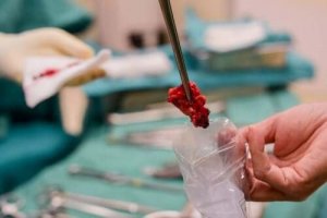 लिक्विड बायोप्सी के फायदे