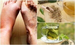 यूरिक एसिड लेवल घटाने के लिए 5 घरेलू नुस्ख़े