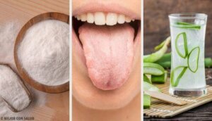 सफ़ेद जीभ : 8 नुस्ख़े